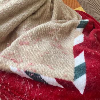 Battaniyenin Aşırı Tüy Dökmesi Ve Müşteri Hizmetlerinin Cevapsızlığı