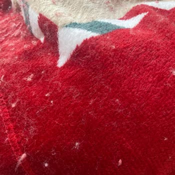 Battaniyenin Aşırı Tüy Dökmesi Ve Müşteri Hizmetlerinin Cevapsızlığı