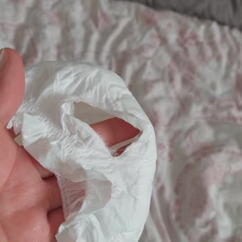 Bebek Bezinde Lastik Yırtılması Sık Görülüyor Ve Kullanım Zorlaşıyor