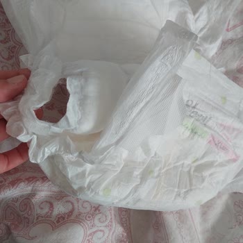 Bebek Bezinde Lastik Yırtılması Sık Görülüyor Ve Kullanım Zorlaşıyor