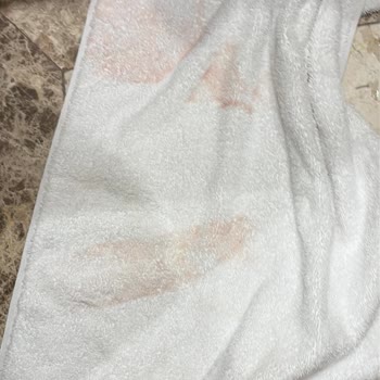 Rixos Hotels Odama Bırakılan Havlulardan Birinin Kirli ve Kanlı Olması