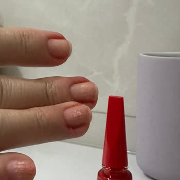 Flormar Ojede 3 Gün Sonra Tırnakta Sarı Lekeler Ve Pütürlülük