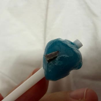 Topitop Ürünün İçindeki Metal Parça Çocuğumun Sağlığını Riske Attı