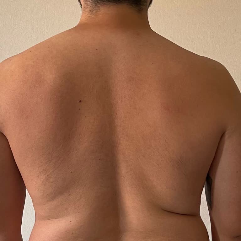 Vaat Edilen %90 Bitiş Garantisi Sağlanmadı Ve 30.000 TL İade Talebi