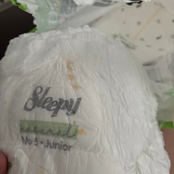 Sleepy Bebek Bezinde Sarı Lekeler Ve Kalite Kontrol Sorunu