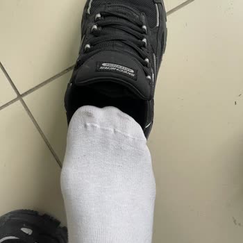 Ayakkabının Boyası Çorapları Boyuyor Ve Değişim Talebim Reddedildi