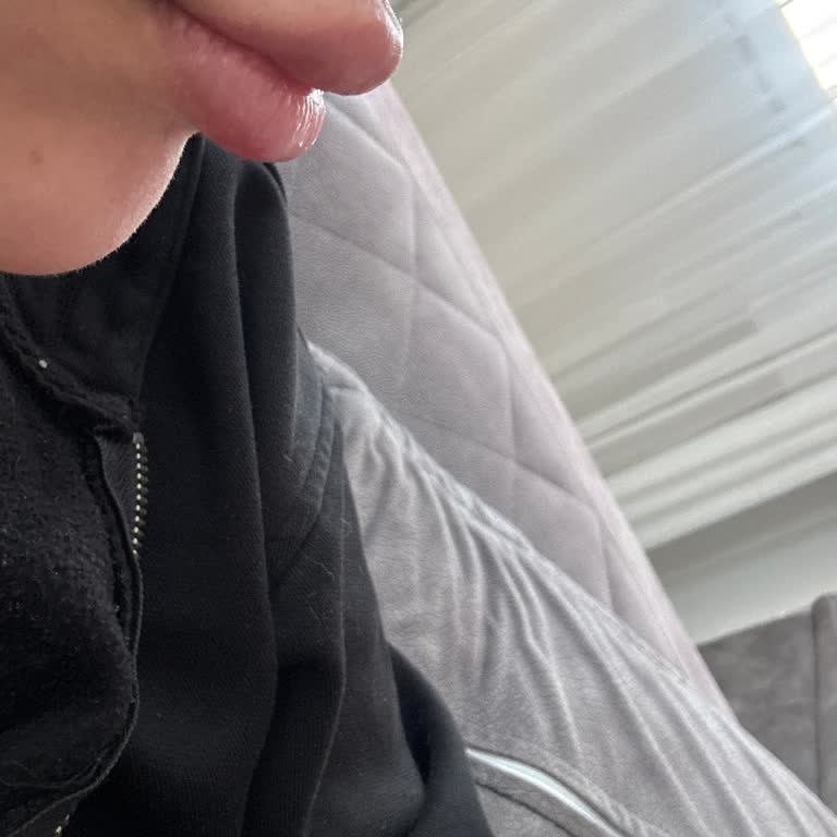 Kadıköy Mia Estetik'te Baloncuklu Dudak Dolgusu Ve Yapay Görünüm, Şikayet Cevapsız