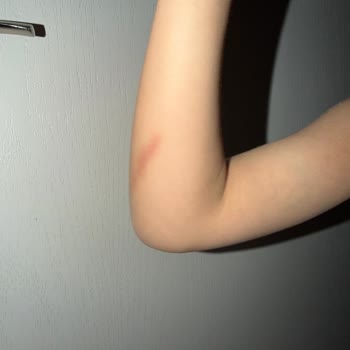 Rengin Anaokulu Öğretmenin Vurması