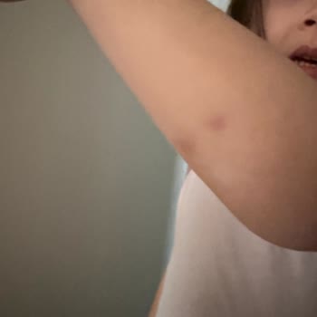 Rengin Anaokulu Öğretmenin Vurması