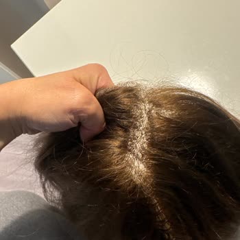 Gerçek Saç İddiası Ve 50 Bin TL'lik Perukta Kalitesiz Ürün