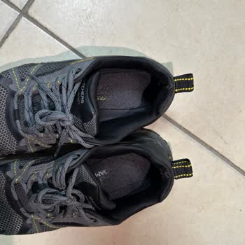 Kısa Sürede Deforme Olan Ayakkabının Yara Açması Ve Mağduriyetim