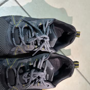 Kısa Sürede Deforme Olan Ayakkabının Yara Açması Ve Mağduriyetim