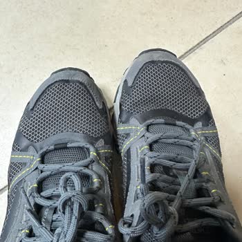 Kısa Sürede Deforme Olan Ayakkabının Yara Açması Ve Mağduriyetim