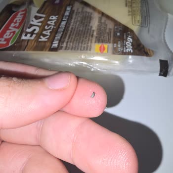 Peysan Kaşarda Metal Parça Bulunması Ve Sağlık Tehlikesi Oluşturdu