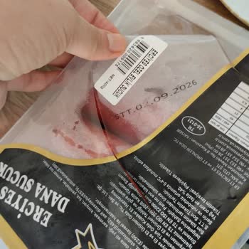 Sucukta Yabancı Sert Cisim Bulundu, Diş Ağrısı Ve Sağlık Endişesi