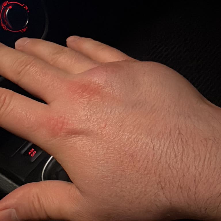 Doğa Sigorta’da 40 Dakika Bekleme Ve Provizyon Redi Mağduriyeti