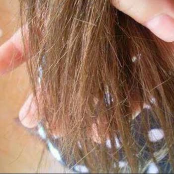 Garage Hair Caddebostan Şubesinde Üç Kat Fazla Fiyat Ve Saygısız Tutum