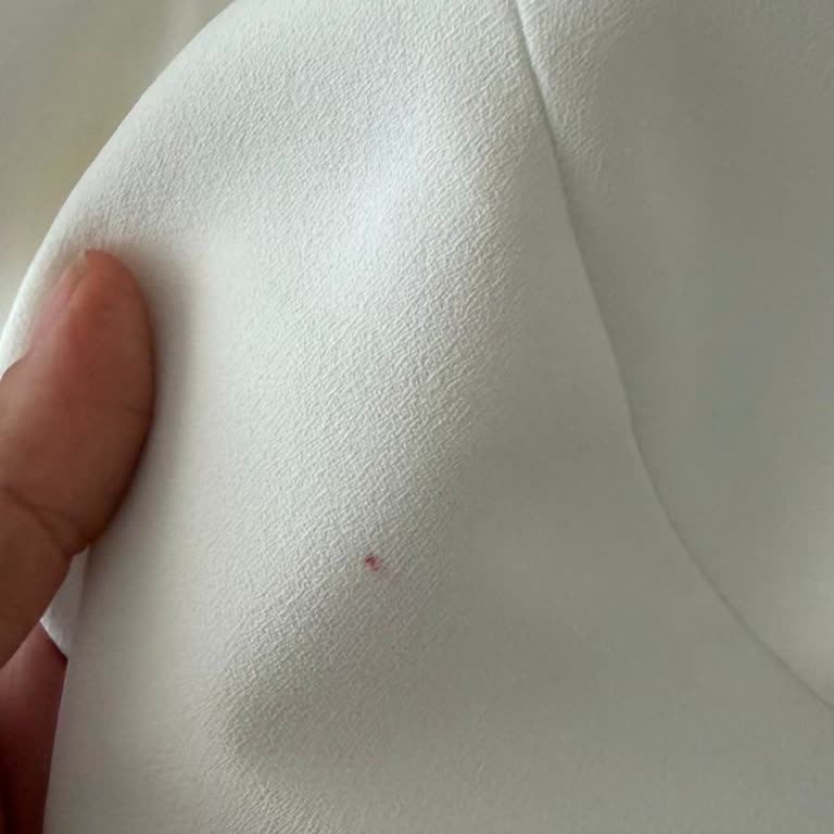 Kırmızı Leke Ve Küçük Bedenli Ceket, İade Süreci Uzun Sürüyor