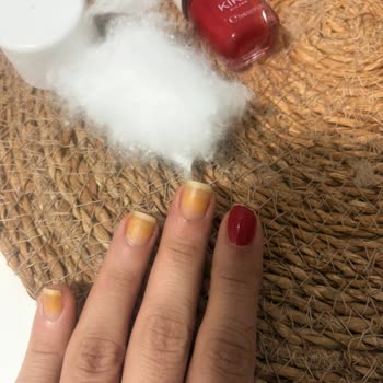 Kiko Ojesi Tırnaklarımı Sararttı, Teklif Edilen Telafi Yetersiz