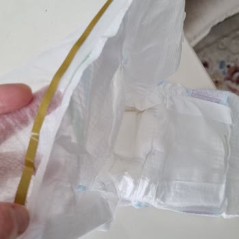 Molfix Bebek Bezinde Belirlenemeyen Bir Şey: Sağlık Riski Ve Açıklama Talebi