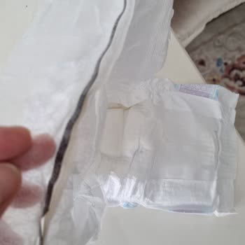 Molfix Bebek Bezinde Belirlenemeyen Bir Şey: Sağlık Riski Ve Açıklama Talebi