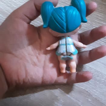 Görünüşte Sorunsuz Bebek Kıyafeti Açık Kaldı Uzaktan Çözüm İstiyorum