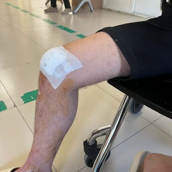 Palm World Side Duşakabin Camı Sıcaktan Dolayı Genleşme Sonucu Aniden Patladı