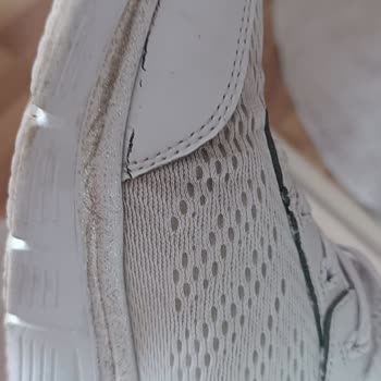 Skechers Ayakkabısında Erken Soyulma Ve Kullanıcı Hatası İddiası Reddi