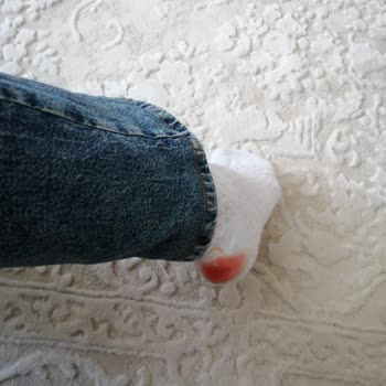 Lacoste Sneaker İlk Kullanımda Ayağı Kesiyor, Değişim Şansı Yok