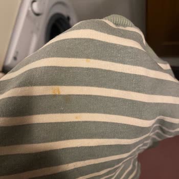 Aynı Sorunlu İki LG Çamaşır Makinesi, İade Reddedildi