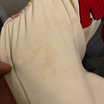 Aynı Sorunlu İki LG Çamaşır Makinesi, İade Reddedildi