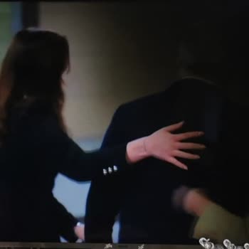 Üç Yıllık Kullanım Sonrası Tekrarlayan Kararma Ve Garanti Dışı Destek Talebi