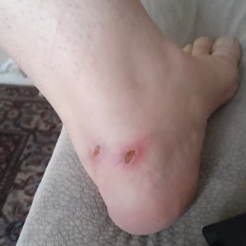 FLO Ayakkabısı Topuktan Vuruyor Ve Ücret İadesi Talep Ediyorum