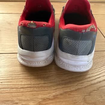 Kısa Sürede Deformasyon Gösteren Skechers Ayakkabısında Bilek Kısmı Sökükleri