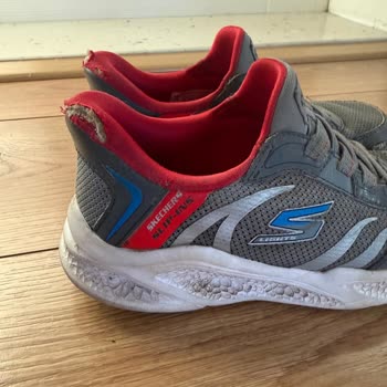 Kısa Sürede Deformasyon Gösteren Skechers Ayakkabısında Bilek Kısmı Sökükleri