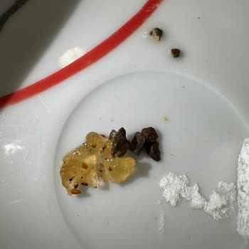 USAŞ Fındıklı Lokumunda Taş Bulunması Ve Diş Hasarı