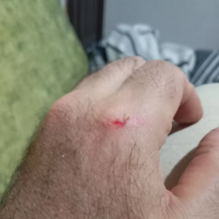A101 Market Önünde Sokak Köpeklerinin Saldırısı Güvenlik Riskine Dönüştürüyor