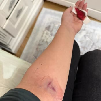 Bezmialem Hastanesi KBB'de Yanlış Reçete, Güvensiz Uygulama Ve Ücret İadesi Talebi