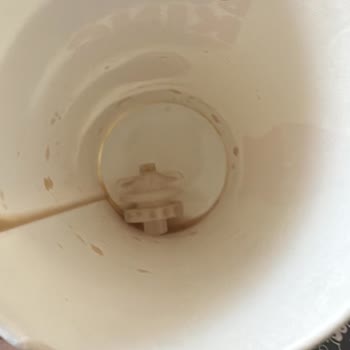 Kola Tıpa Bulgusu Hijyen İhlali Ve Şube İletişimsizliği