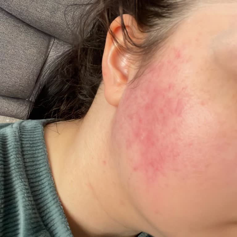 Sözde Temiz Nemlendirici Parfümlü Çıktı, Hassas Ciltte Kızarıklık Ve Kaşıntı