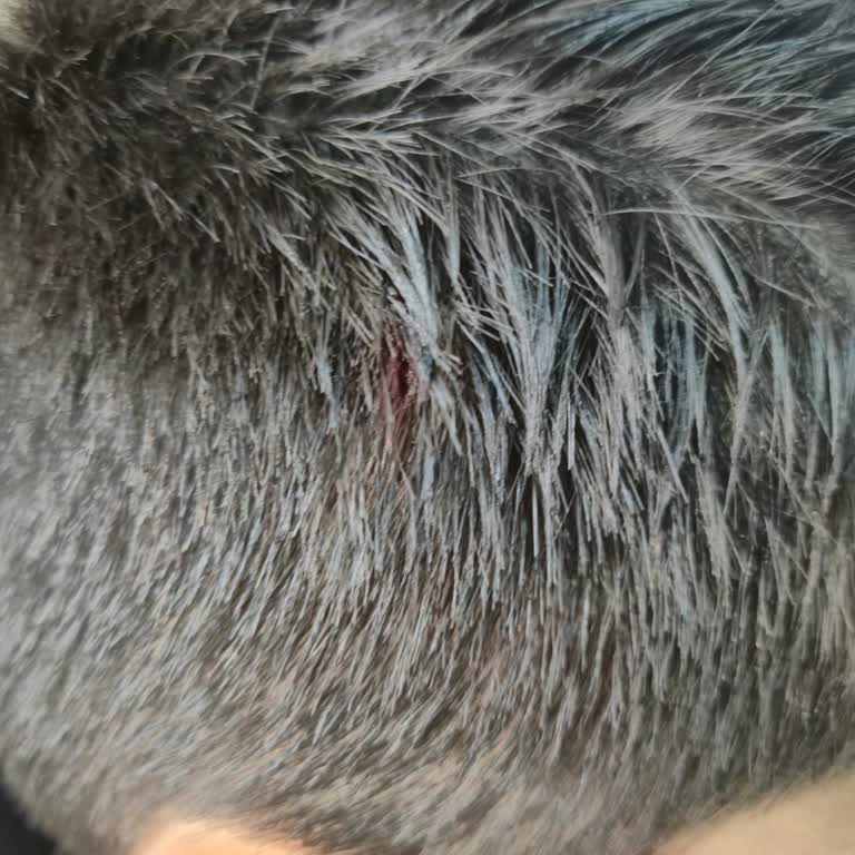 Acil Servis Sekreteri Ve Güvenlik Personelinin Aşağılama Ve Şiddetli Davranışı