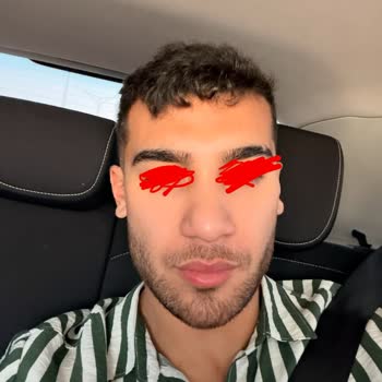 Op. Dr. Hüseyin Karabulut Rinoplasti Sonrası Asimetrik Burun ve Nefes Alma Sorunları