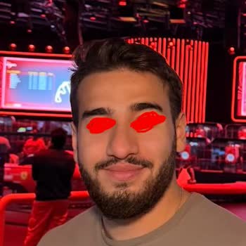 Op. Dr. Hüseyin Karabulut Rinoplasti Sonrası Asimetrik Burun ve Nefes Alma Sorunları