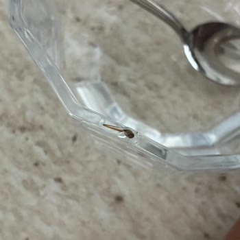 Damacana Suyunda Görülen Siyah Jelimsi Yabancı Madde Ve Şiddetli Karın Ağrısı