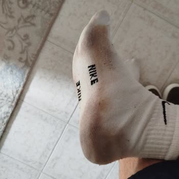 Elle Vizon Deri Günlük Ayakkabı Çorapları Renklendiriyor Ve İade Talebi Reddedildi