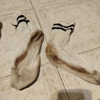 Elle Vizon Deri Günlük Ayakkabı Çorapları Renklendiriyor Ve İade Talebi Reddedildi