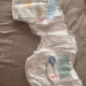 Molfix Premium 2 Bezlerinde Kimyasal Koku Ve Bebek Cilt Kızarıklığı