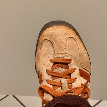 Adidas Gazelle Ayakkabı Boya Salması Ve Renk Dağılması Şikayeti