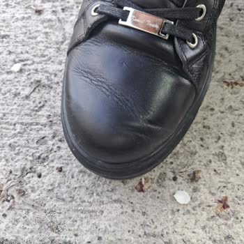 Sağ Tekindeki Deformasyon, Kullanıcı Hatası Olarak Reddi Ve İade Talebi