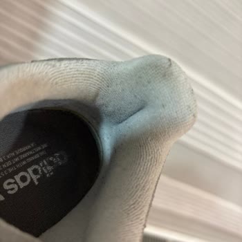 Kısa Sürede Deforme Olan Adidas Ayakkabısının Değişim Talebi Reddedildi